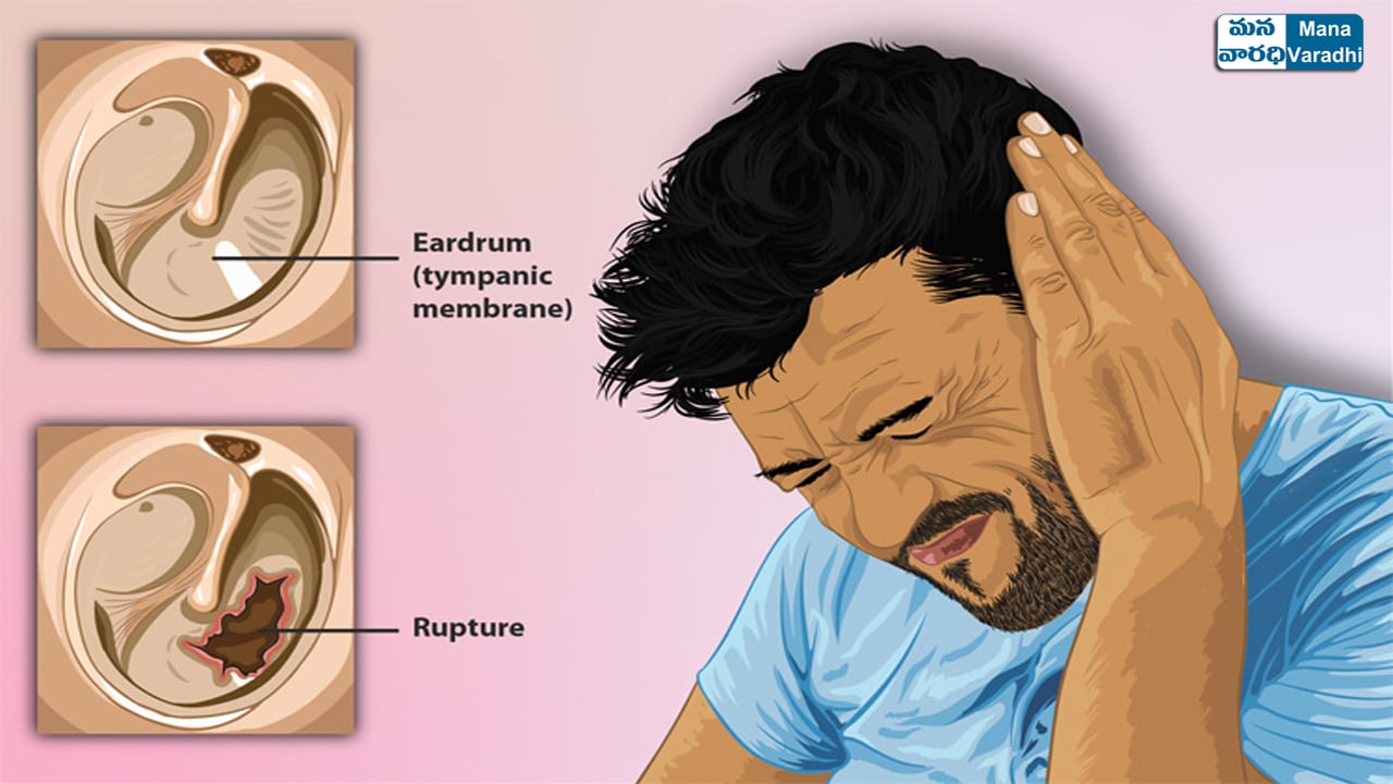 hole in the eardrum