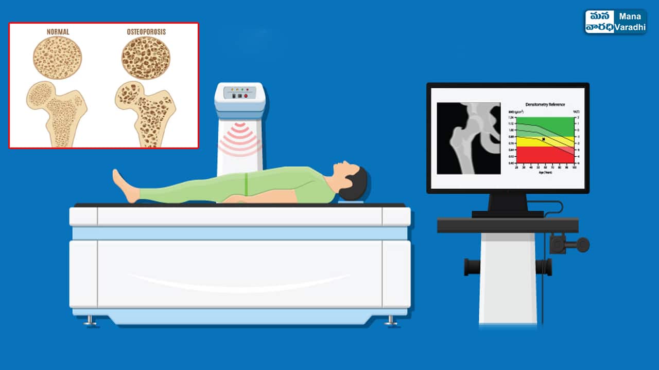 BONE MINERAL DENSITY TEST