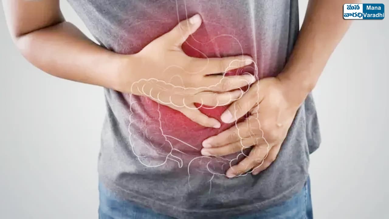 Crohn's disease - Symptoms and causes