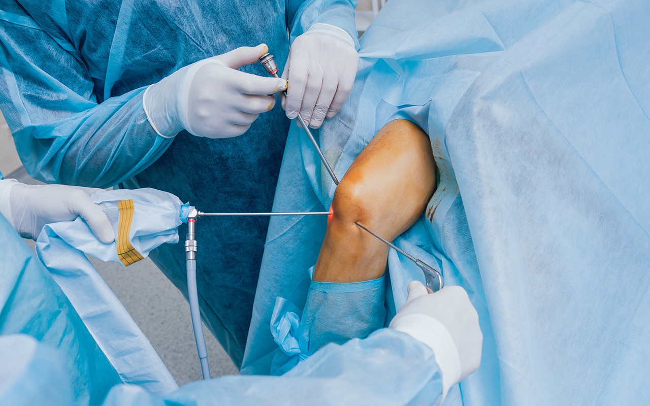 Knee surgery