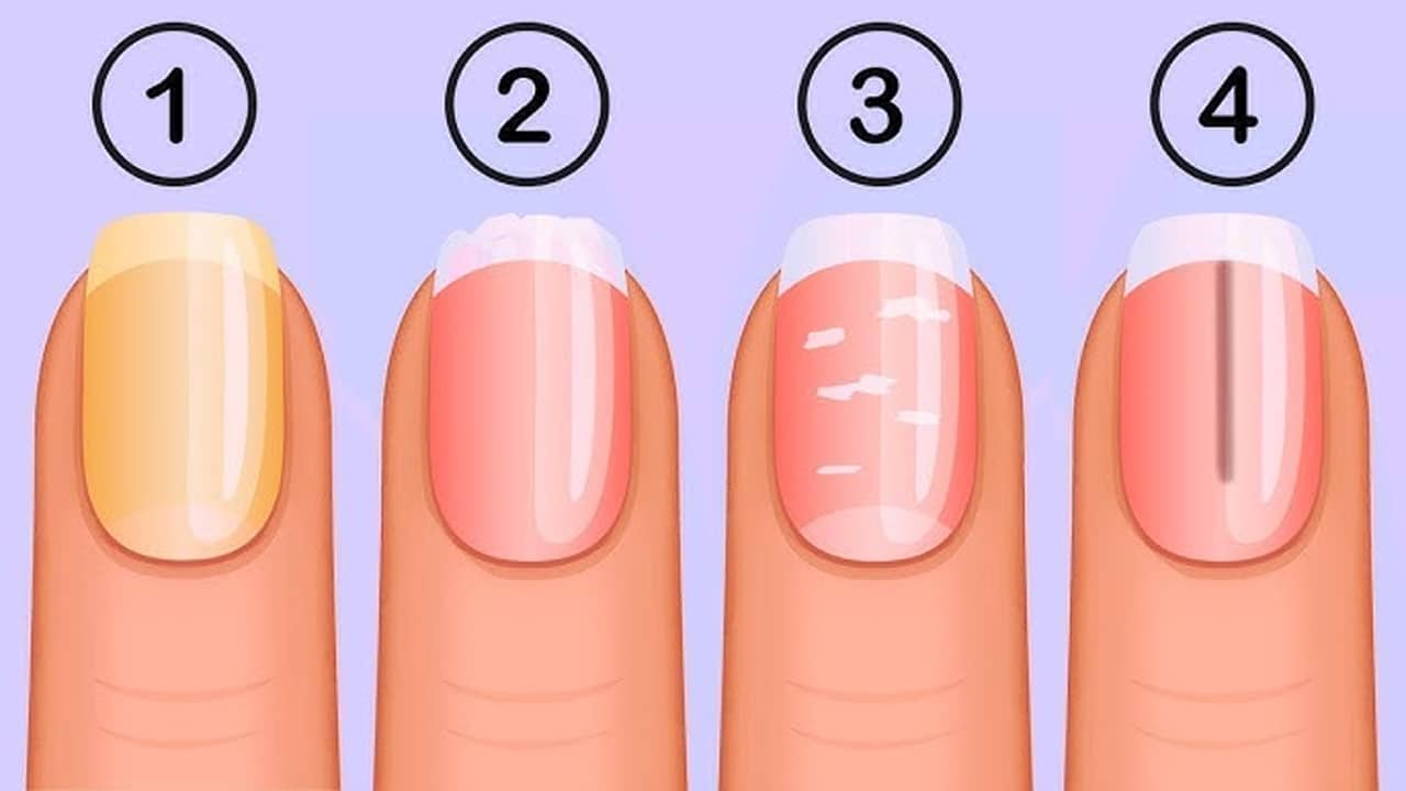 Nails Health