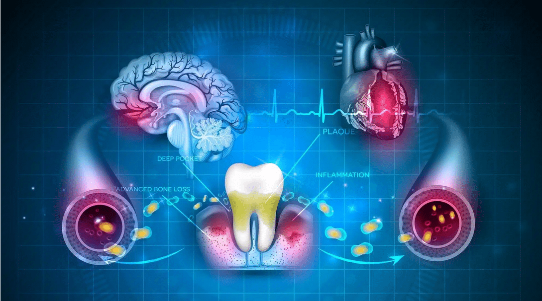 Oral health is overall health