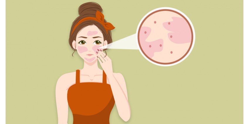 Sensitive Skin Care Tips