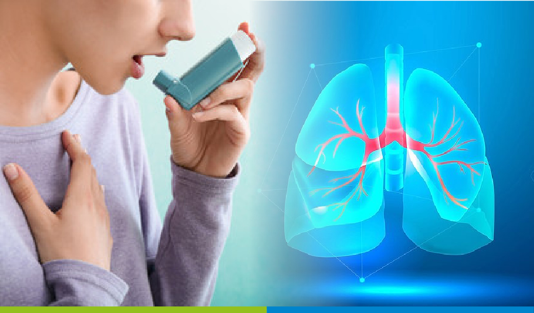 How to Prevent Ashtma